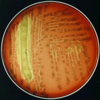 Image: The bacterium Bacillus licheniformis (Photo courtesy of Newcastle University).